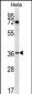 NUP35 Antibody (C-term)